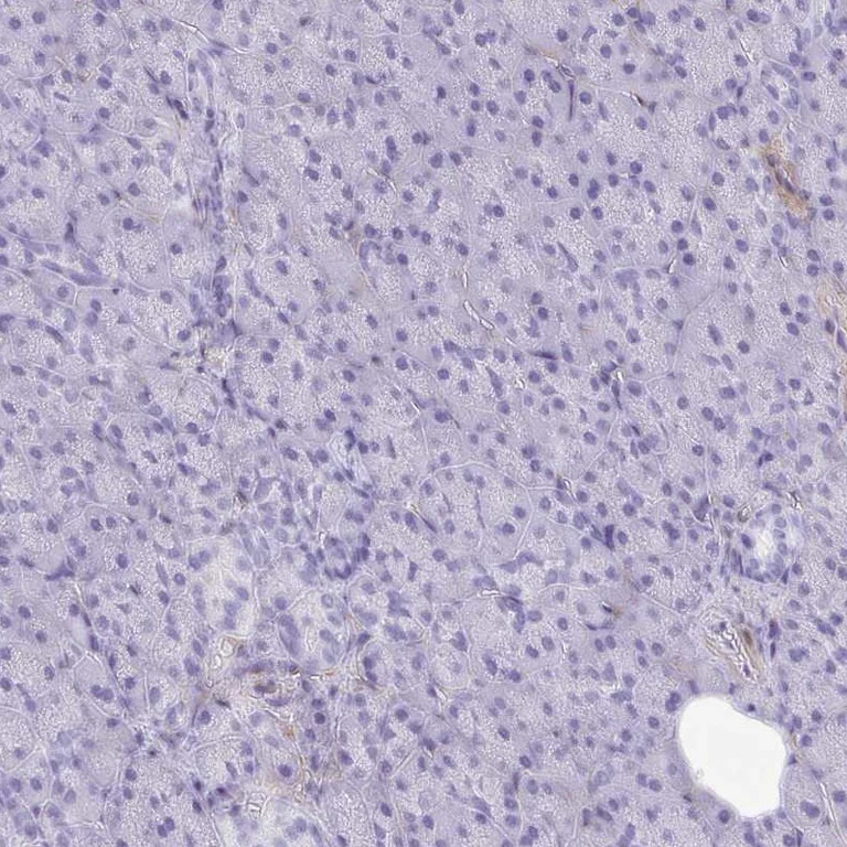 Immunohistochemistry (Formalin/PFA-fixed paraffin-embedded sections) - Anti-PITPnm 3 antibody (AB251739)