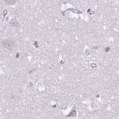 Immunohistochemistry (Formalin/PFA-fixed paraffin-embedded sections) - Anti-PITPnm 3 antibody (AB251739)