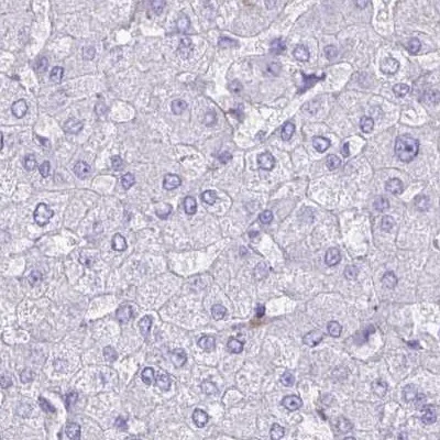 Immunohistochemistry (Formalin/PFA-fixed paraffin-embedded sections) - Anti-PITPnm 3 antibody (AB251739)