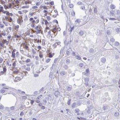 Immunohistochemistry (Formalin/PFA-fixed paraffin-embedded sections) - Anti-PITPnm 3 antibody (AB251739)