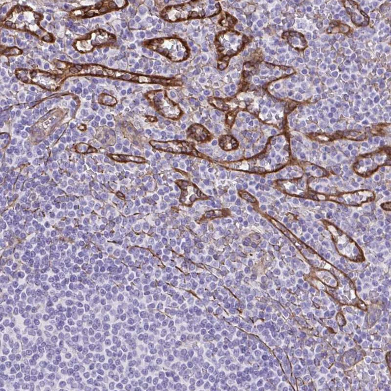 Immunohistochemistry (Formalin/PFA-fixed paraffin-embedded sections) - Anti-PITPnm 3 antibody (AB251739)