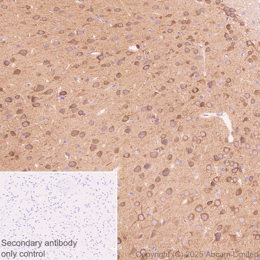 Immunohistochemistry (Formalin/PFA-fixed paraffin-embedded sections) - Anti-PITPnm 3 antibody [EPR28185-157] (AB323452), expandable thumbnail
