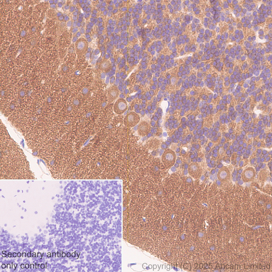Immunohistochemistry (Formalin/PFA-fixed paraffin-embedded sections) - Anti-PITPnm 3 antibody [EPR28185-157] (AB323452), expandable thumbnail