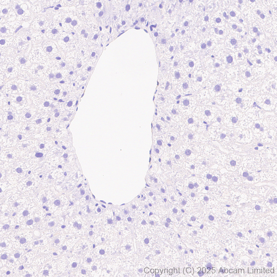 Immunohistochemistry (Formalin/PFA-fixed paraffin-embedded sections) - Anti-PITPnm 3 antibody [EPR28185-157] (AB323452), expandable thumbnail