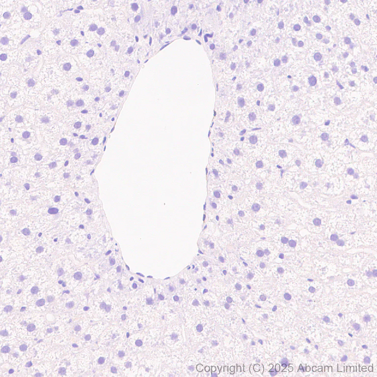 Immunohistochemistry (Formalin/PFA-fixed paraffin-embedded sections) - Anti-PITPnm 3 antibody [EPR28185-157] (AB323452)