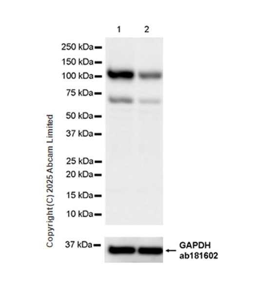 Western blot - Anti-PITPnm 3 antibody [EPR28185-157] (ab323452), expandable thumbnail