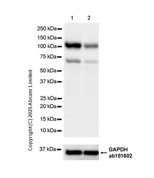 Western blot - Anti-PITPnm 3 antibody [EPR28185-157] (AB323452)