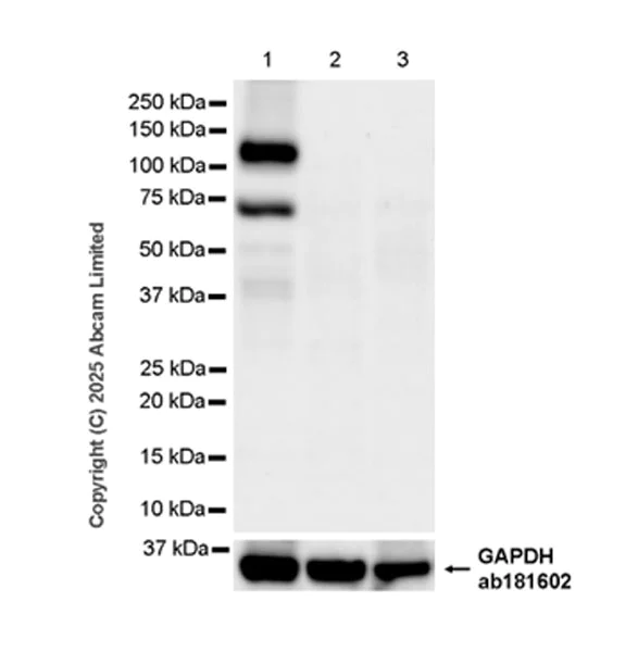 Western blot - Anti-PITPnm 3 antibody [EPR28185-157] (AB323452)