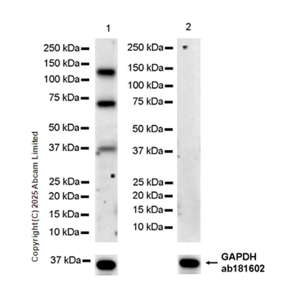 Western blot - Anti-PITPnm 3 antibody [EPR28185-157] (AB323452), expandable thumbnail