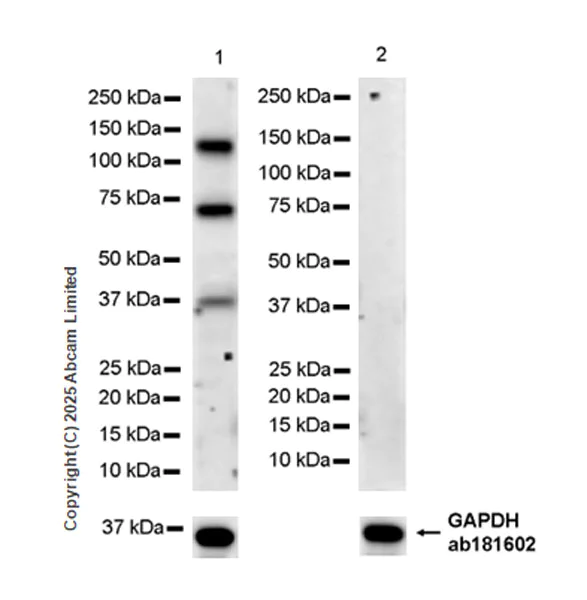 Western blot - Anti-PITPnm 3 antibody [EPR28185-157] (AB323452)