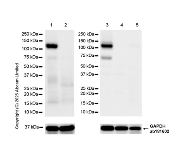 Western blot - Anti-PITPnm 3 antibody [EPR28185-157] (AB323452), expandable thumbnail
