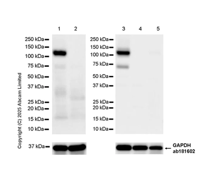 Western blot - Anti-PITPnm 3 antibody [EPR28185-157] (AB323452)