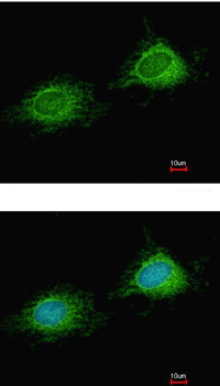 Immunocytochemistry/ Immunofluorescence - Anti-PITRM1 antibody (AB111681)