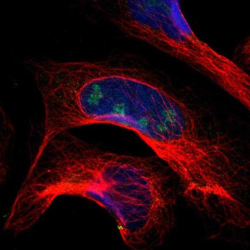 Immunocytochemistry/ Immunofluorescence - Anti-PITX1/BFT antibody (AB244308), expandable thumbnail