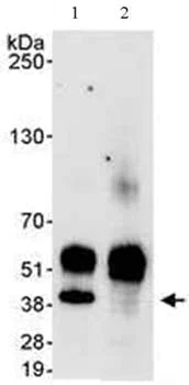 Immunoprecipitation - Anti-PITX1/BFT antibody (AB70273)