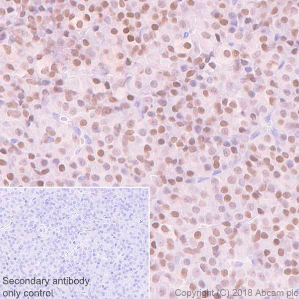 Immunohistochemistry (Formalin/PFA-fixed paraffin-embedded sections) - Anti-PITX2/RGS antibody [EPR22417] (AB221142)