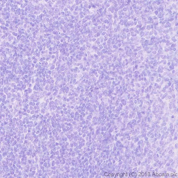 Immunohistochemistry (Formalin/PFA-fixed paraffin-embedded sections) - Anti-PITX2/RGS antibody [EPR22417] - BSA and Azide free (AB244343)