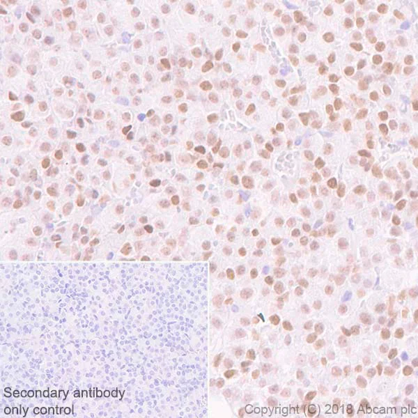 Immunohistochemistry (Formalin/PFA-fixed paraffin-embedded sections) - Anti-PITX2/RGS antibody [EPR22417] - BSA and Azide free (AB244343)