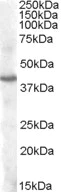 Western blot - Anti-PITX3/PTX3 antibody (AB106827)