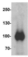 Western blot - Anti-PIWIL2 antibody (AB181340)