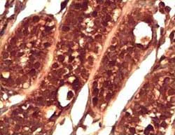 Immunohistochemistry (Formalin/PFA-fixed paraffin-embedded sections) - Anti-PIWIL2 antibody (AB85084)