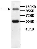 Western blot - Anti-PIWIL2 antibody (AB85084)