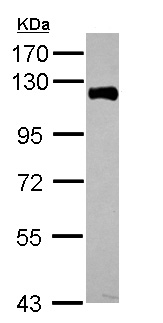 Western blot - Anti-PIWIL4/PIWI antibody (AB111714), expandable thumbnail