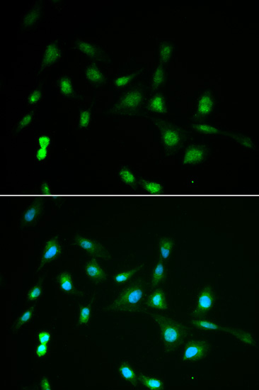 Immunocytochemistry/ Immunofluorescence - Anti-PIWIL4/PIWI antibody (AB180867), expandable thumbnail