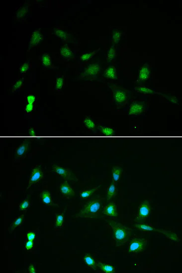 Immunocytochemistry/ Immunofluorescence - Anti-PIWIL4/PIWI antibody (AB180867)