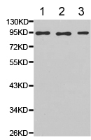 Western blot - Anti-PIWIL4/PIWI antibody (AB180867), expandable thumbnail