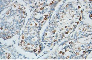 Immunohistochemistry (Formalin/PFA-fixed paraffin-embedded sections) - Anti-PIWIL4/PIWI antibody (AB87939)