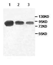 Western blot - Anti-PIWIL4/PIWI antibody (AB87939)