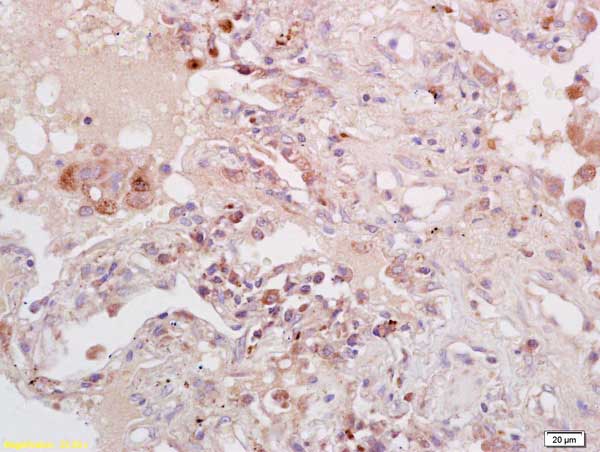 Immunohistochemistry (Formalin/PFA-fixed paraffin-embedded sections) - Anti-PKA alpha + beta (catalytic subunits) antibody (AB216572), expandable thumbnail
