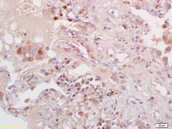 Immunohistochemistry (Formalin/PFA-fixed paraffin-embedded sections) - Anti-PKA alpha + beta (catalytic subunits) antibody (AB216572)
