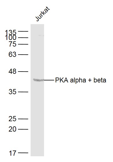 Western blot - Anti-PKA alpha + beta (catalytic subunits) antibody (AB216572), expandable thumbnail