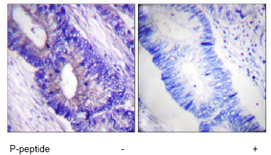 Immunohistochemistry (Formalin/PFA-fixed paraffin-embedded sections) - Anti-PKA alpha + beta (catalytic subunits) (phospho T197) antibody (AB59218), expandable thumbnail