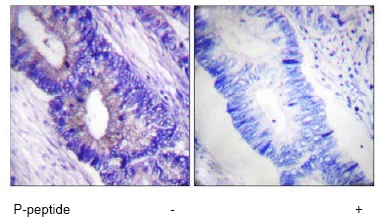 Immunohistochemistry (Formalin/PFA-fixed paraffin-embedded sections) - Anti-PKA alpha + beta (catalytic subunits) (phospho T197) antibody (AB59218)