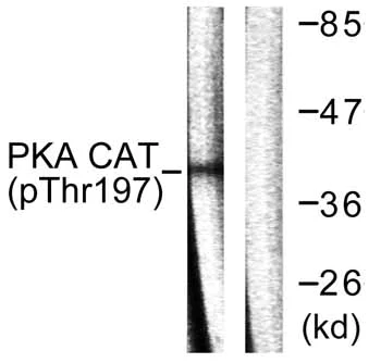 Western blot - Anti-PKA alpha + beta (catalytic subunits) (phospho T197) antibody (AB59218)