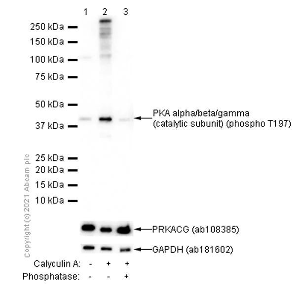 Western blot - Anti-PKA alpha/beta/gamma (catalytic subunit) (phospho T197) antibody [EP2606Y] (AB75991)