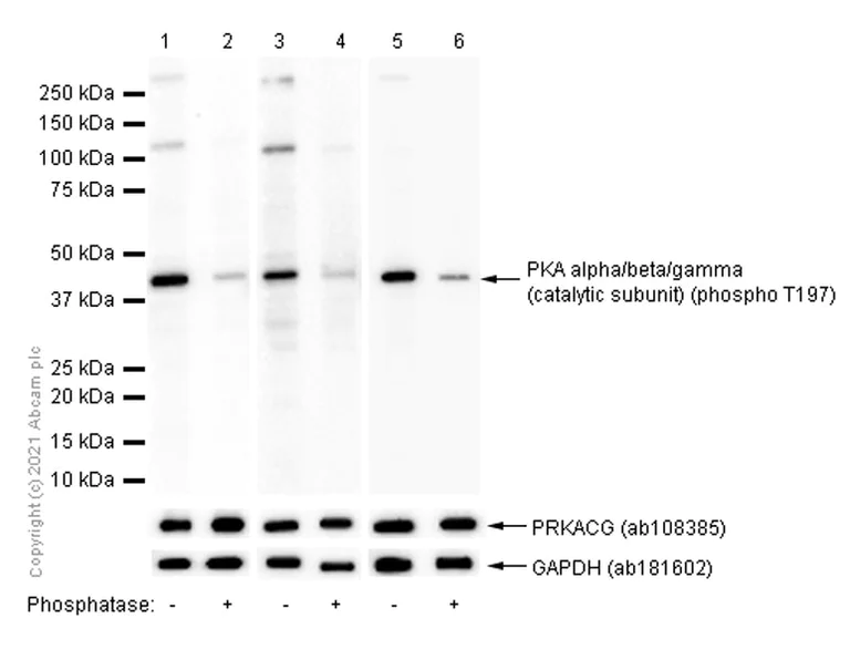 Western blot - Anti-PKA alpha/beta/gamma (catalytic subunit) (phospho T197) antibody [EP2606Y] (AB75991)