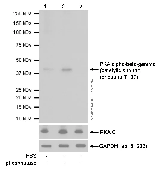 Western blot - Anti-PKA alpha/beta/gamma (catalytic subunit) (phospho T197) antibody [EP2606Y] (AB75991)