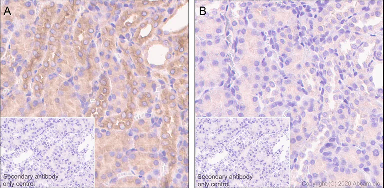 Immunohistochemistry (Formalin/PFA-fixed paraffin-embedded sections) - Anti-PKA alpha/beta/gamma (catalytic subunit) (phospho T197) antibody [EP2606Y] - BSA and Azide free (AB227848)