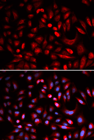Immunocytochemistry/ Immunofluorescence - Anti-PKA beta (catalytic subunit) antibody (AB187515)