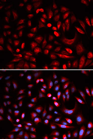 Immunocytochemistry/ Immunofluorescence - Anti-PKA beta (catalytic subunit) antibody (AB187515)
