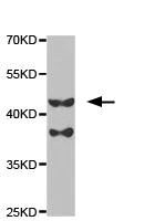 Western blot - Anti-PKA beta (catalytic subunit) antibody (AB187515)