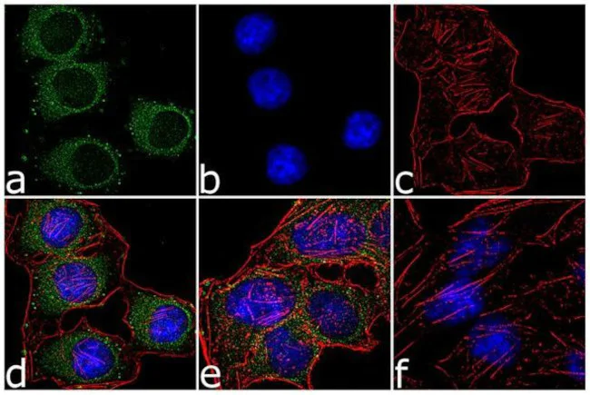 Immunocytochemistry/ Immunofluorescence - Anti-PKA beta catalytic subunit (pT197) + cAMP PK Catalytic subunit (pT197) Antibody [RP23040216] (AB313487)