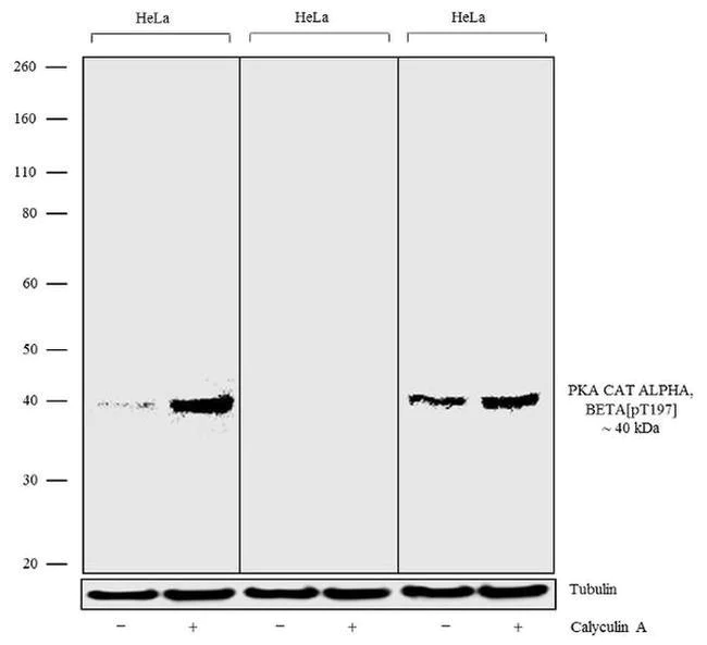 Western blot - Anti-PKA beta catalytic subunit (pT197) + cAMP PK Catalytic subunit (pT197) Antibody [RP23040216] (AB313487)