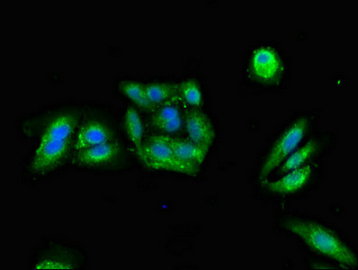 Immunocytochemistry/ Immunofluorescence - Anti-PKA R2/PKR2 antibody (AB236855), expandable thumbnail