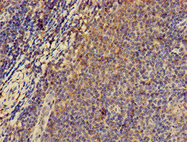 Immunohistochemistry (Formalin/PFA-fixed paraffin-embedded sections) - Anti-PKA R2/PKR2 antibody (AB236855), expandable thumbnail