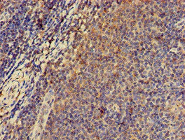 Immunohistochemistry (Formalin/PFA-fixed paraffin-embedded sections) - Anti-PKA R2/PKR2 antibody (AB236855)